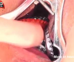 extraeme bdsm, masochiste tortura sua tappi di bottiglia di figa whiteh